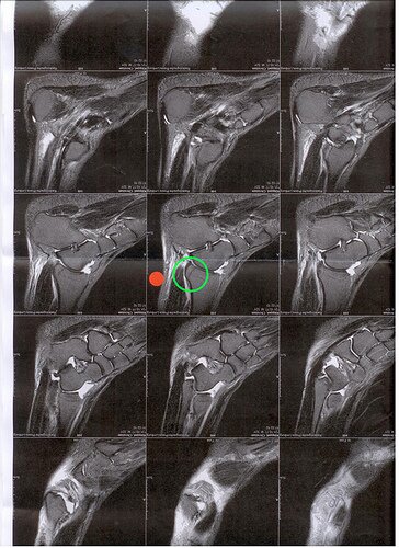 Wie gefährlich ist Röntgenstrahlung für den menschlichen Körper? ©Flickr/christian.kloeppel