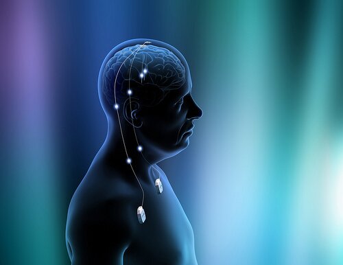 Der Schlaganfall gehört weltweit zu den häufigsten Todesursachen © flickr/bvmed Der Schlaganfall gehört weltweit zu den häufigsten Todesursachen © flickr/bvmed